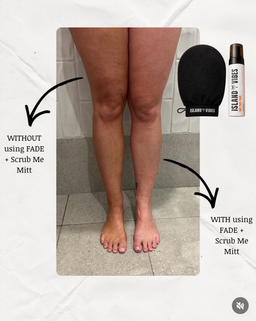 Tan Remover Bundle